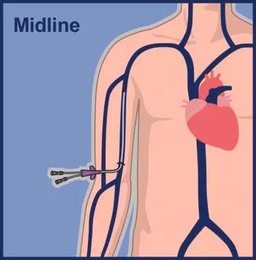 Midline image